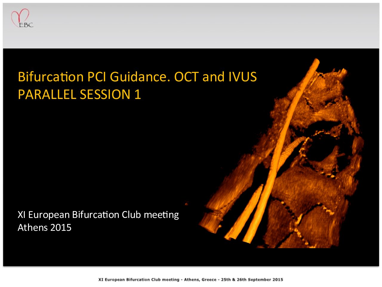 You are currently viewing Bifurcation PCI Guidance. OCT and IVUS PARALLEL SESSION 1