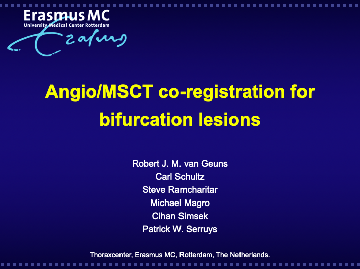 You are currently viewing Angio/MDCT co-registration for bifurcation lesions
