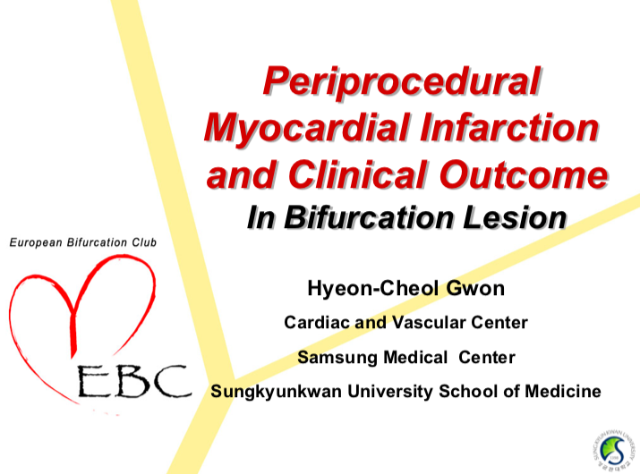 Read more about the article Periprocedural Myocardial Infarction and Clinical Outcome In Bifurcation Lesion