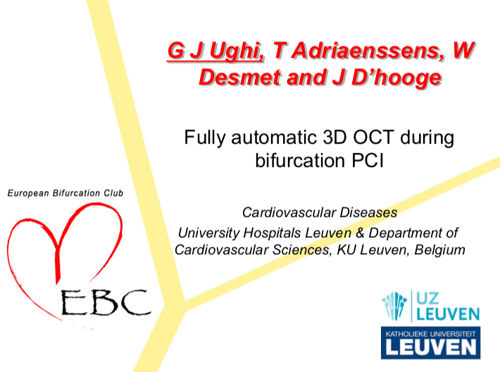 You are currently viewing Fully automatic 3D OCT during bifurcation PCI