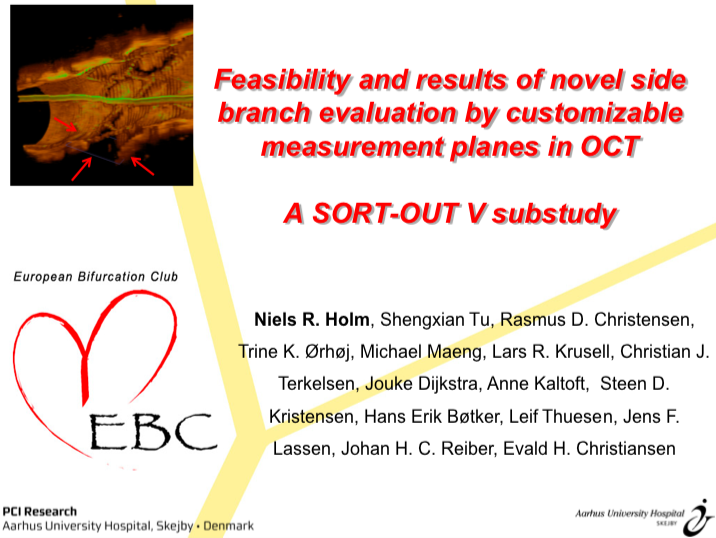 You are currently viewing Feasibility and results of novel side branch evaluation by customizable measurement planes in OCT – A SORT-OUT V substudy