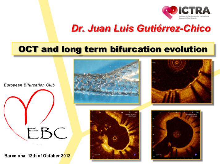 Read more about the article OCT and long term bifurcation evolution