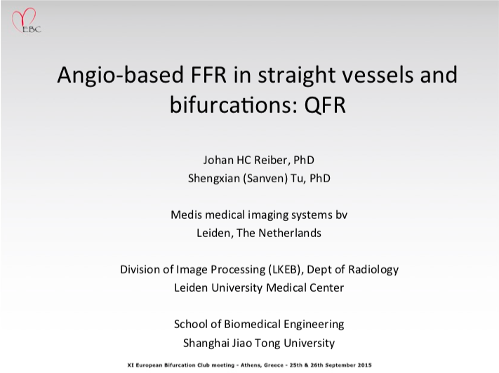 You are currently viewing Angio-based FFR in straight vessels and bifurcations: QFR