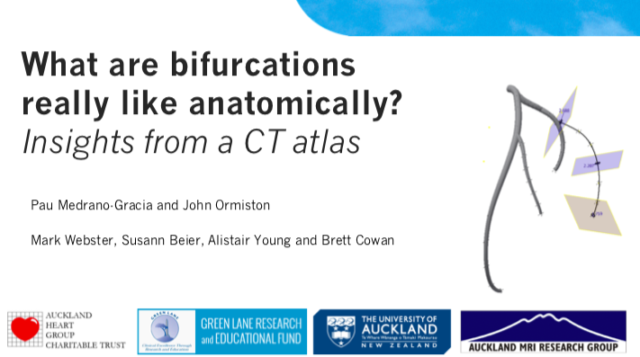 You are currently viewing What are bifurcations really like anatomically? Insights from a CT atlas