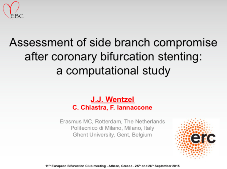 Read more about the article Assessment of side branch compromise after coronary bifurcation stenting: a computational study