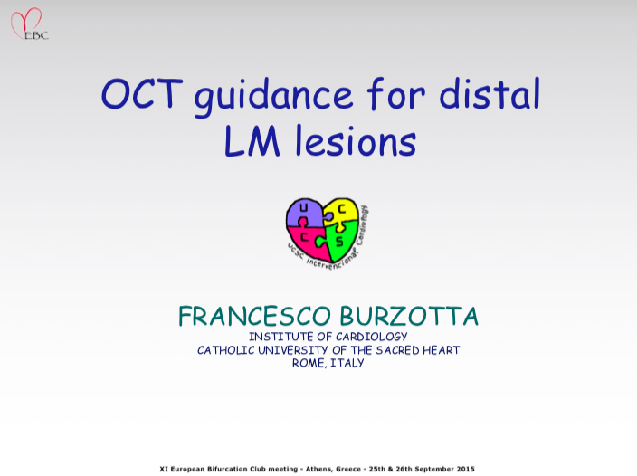 You are currently viewing OCT guidance for distal LM lesions
