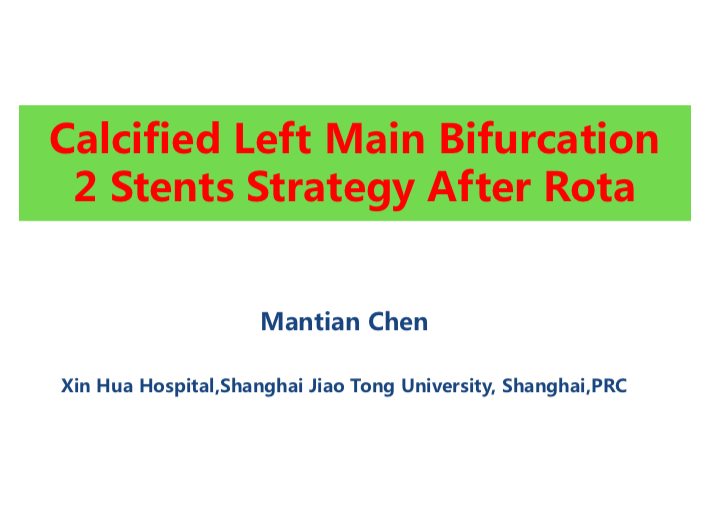 Read more about the article Calcified Left Main Bifurcation 2 Stents Strategy After Rotation 2 Stents Strategy After Rota