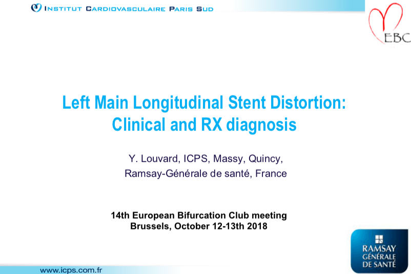 Read more about the article Left Main Longitudinal Stent Distortion: Clinical and RX diagnosis