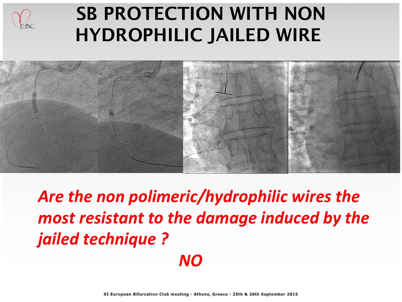 Read more about the article SB PROTECTION WITH NON HYDROPHILIC JAILED WIRE – NO