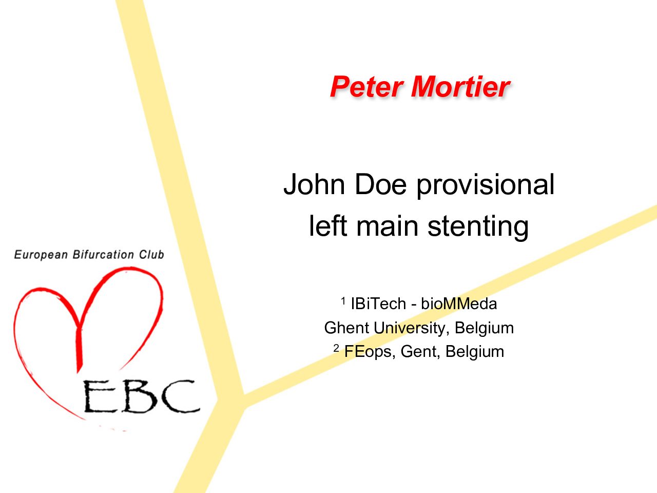 Read more about the article John Doe provisional left main stenting
