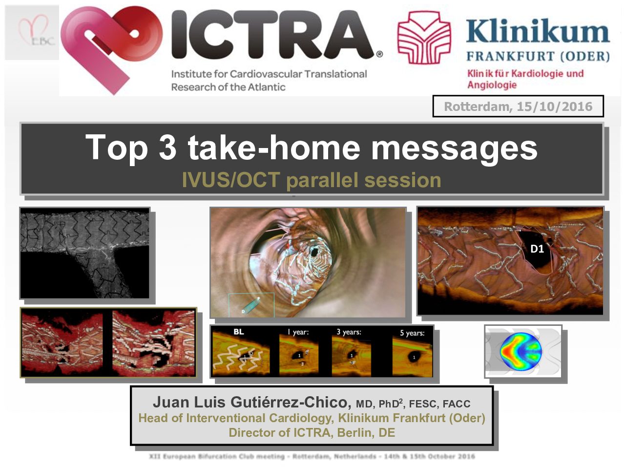 You are currently viewing Top 3 take-home messages IVUS/OCT parallel session