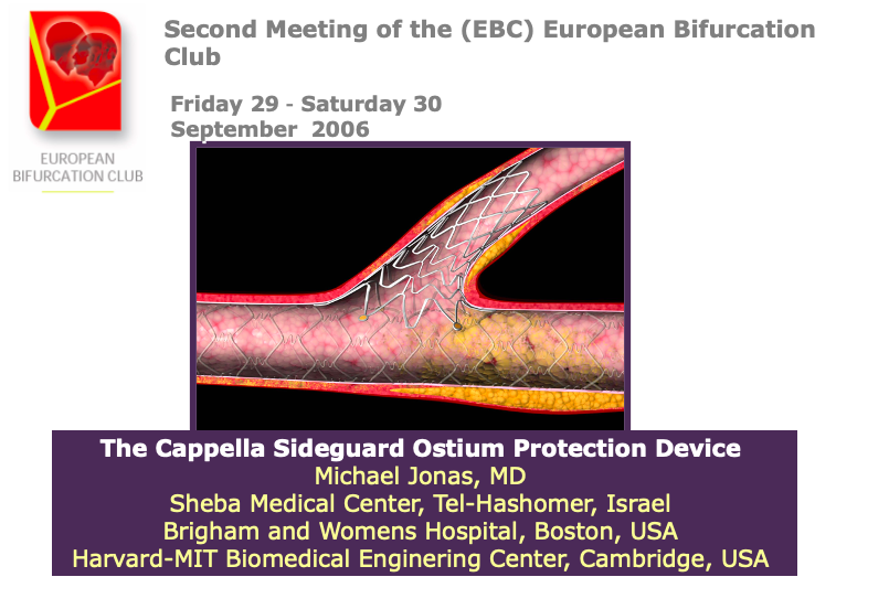 You are currently viewing The Cappella Sideguard Ostium Protection Device