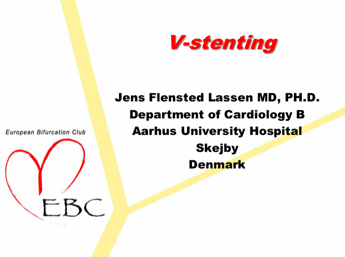 You are currently viewing V-stenting