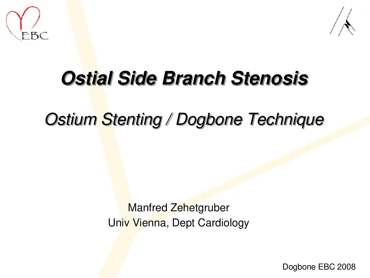 Read more about the article Ostial Side Branch Stenosis Ostium Stenting / Dogbone Technique