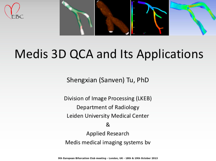 You are currently viewing 3D QCA by Medis