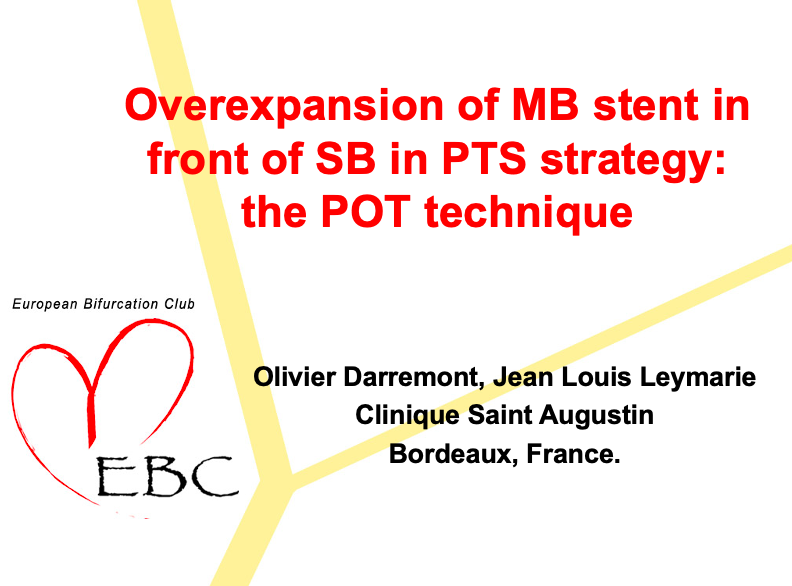 Read more about the article Overexpansion of MB stent in front of SB in PTS strategy the POT technique