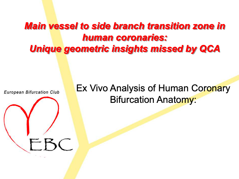 Read more about the article MV to SB transition zone in human coronaries: Unique geometric insights missed by QCA