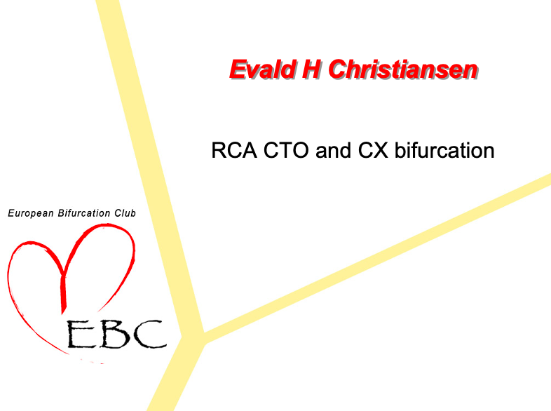 Read more about the article Case 1: Retrograde CTO wiring of CX bifurcation