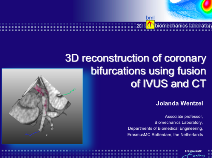 Read more about the article John Doe LM stenosis simulation: 3D angio, IVUS, CT, OCT