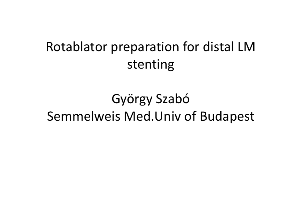 You are currently viewing Rotablator preparation for distal LM stenting