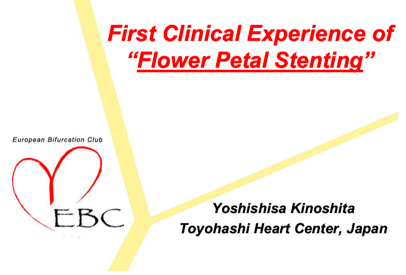 You are currently viewing First clinical experience of “flower petal stenting”