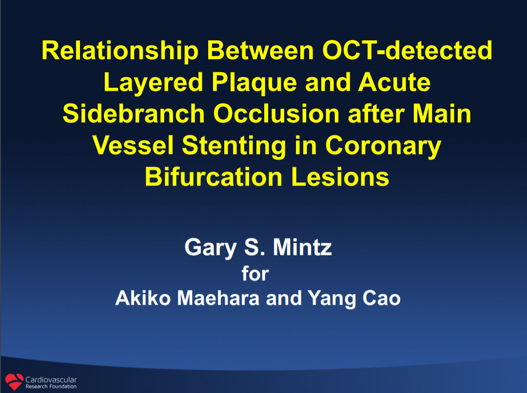 Read more about the article Relationship Between OCT-detected Layered Plaque and Acute Sidebranch Occlusion after Main Vessel Stenting in Coronary Bifurcation Lesions