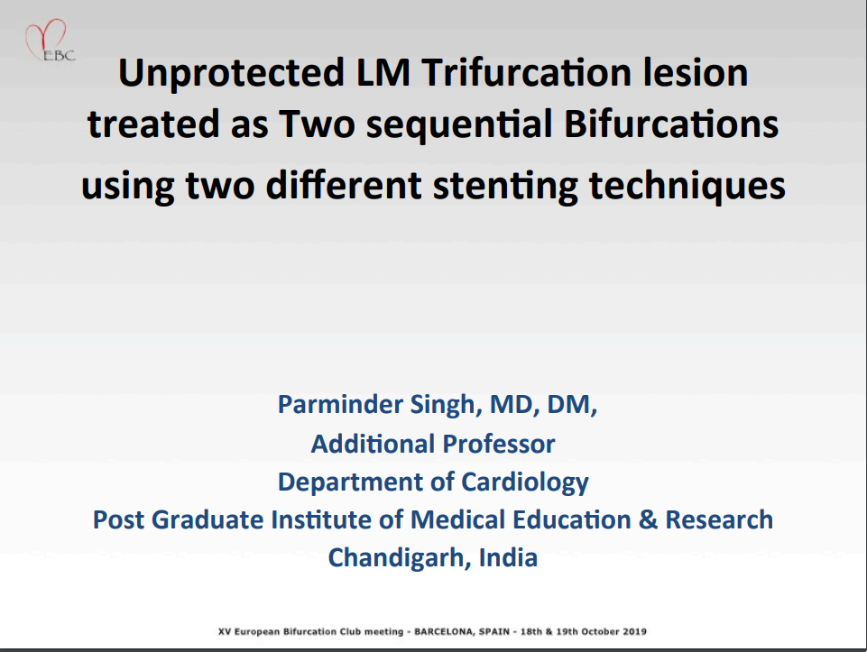 Read more about the article Unprotected LM Trifurcation Lesion treated as two sequential bifurcations