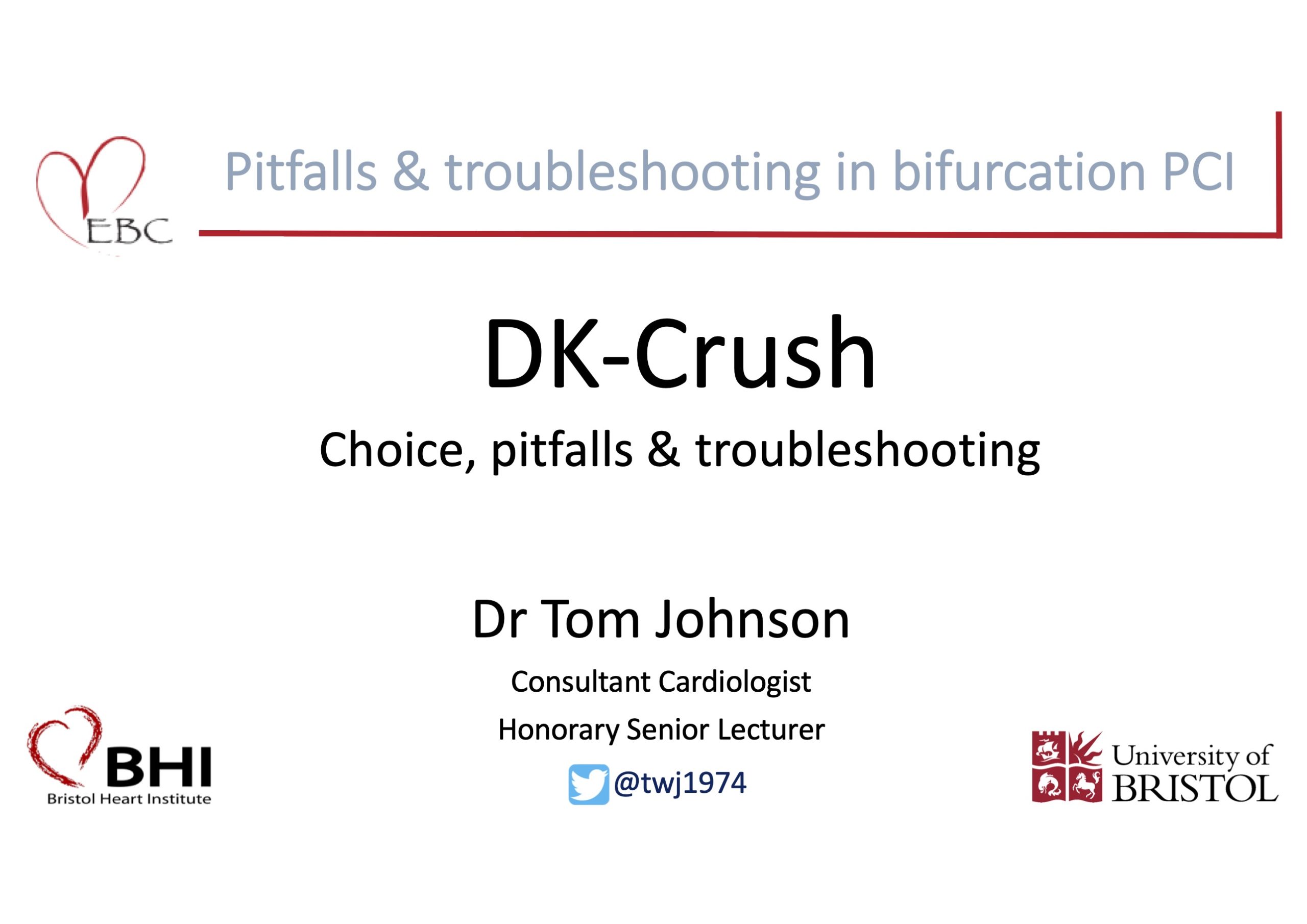 Read more about the article DK-Crush: Choices, pitfalls and troubleshooting – Dr Tom Johnson